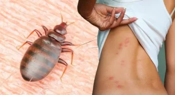 Bed bugs: best to avoid insecticides as much as possible